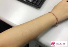 手毛很長是什么原因？