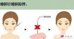 等離子光纖溶脂瘦臉效果維持多久？