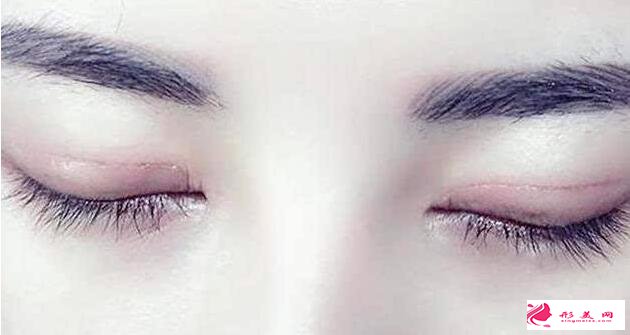 全切雙眼皮后能喝酒嗎