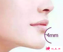 假體墊下巴手術安全嗎?