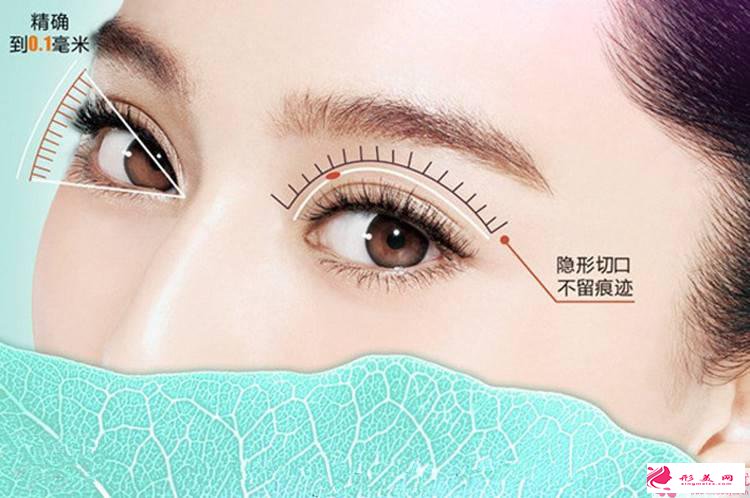 做雙眼皮整形的費用是與什么有關(guān)系