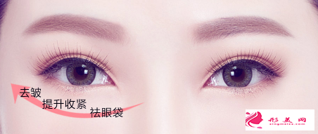 手術切除眼袋安全嗎