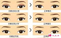 大連沙醫(yī)生整形怎么樣?價格表