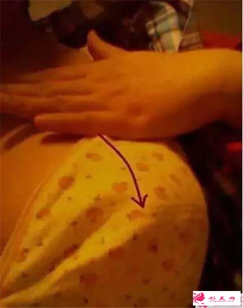 乳暈縮小手術后遺癥_乳暈縮小手術后會留疤嗎？