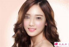 假體豐太陽穴的價(jià)錢是多少？