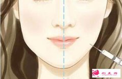 打瘦臉針的副作用對人體有危害嗎