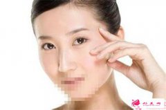 怎樣可以消除下眼袋