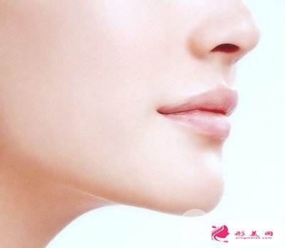 墊下巴后應(yīng)該怎么護(hù)理，多久能消腫？