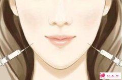 在廣州打瘦臉針的價(jià)格