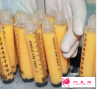 自體脂肪豐臉頰怎么樣？