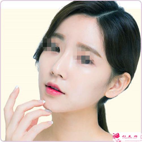 自體隆鼻手術(shù)適合哪類人(Autogenous rhinoplasty)