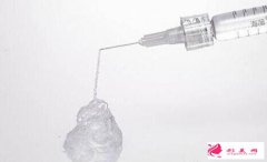 哪些人不適合玻尿酸豐下巴?