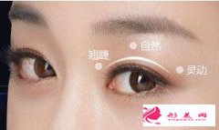 切開(kāi)雙眼皮術(shù)前術(shù)后要注意什么？