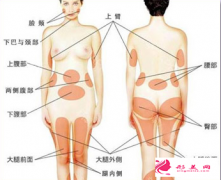 吸脂減肥不等于減重