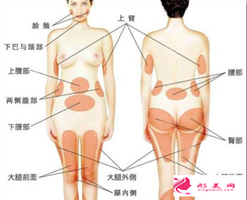 吸脂減肥不等于減重