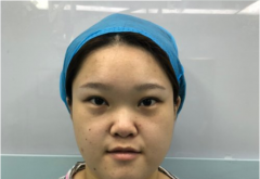 惠州瑞芙臣醫(yī)療美容診所價格表全覽附吸脂案例效果對比