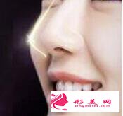 廣州自體軟骨隆鼻多少錢(qián)