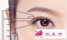 切開雙眼皮后有什么癥狀需要注意的
