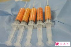 做自體脂肪隆胸的脂肪會堆積成硬塊嗎