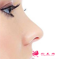 自體軟骨隆鼻會(huì)出現(xiàn)移位的問題嗎