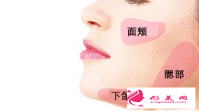 自體脂肪填充臉部后可以減肥嗎