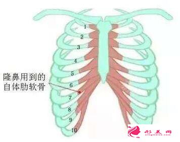 什么情況下不能做肋軟骨隆鼻嗎