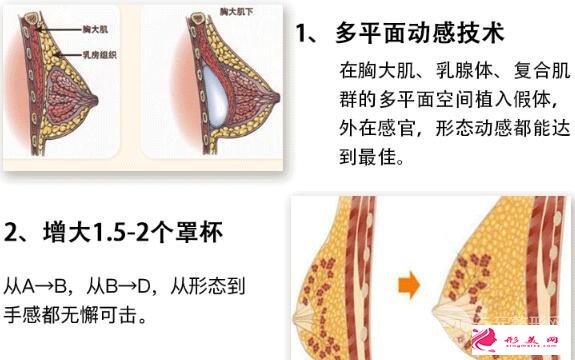 復(fù)合隆胸是什么？可以維持多久？