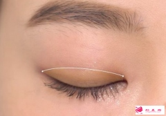 廣州雙眼皮手術(shù)多少錢？