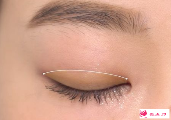 廣州雙眼皮手術(shù)多少錢