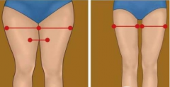 吸脂瘦大腿腫脹期是多久？多久能看到效果？