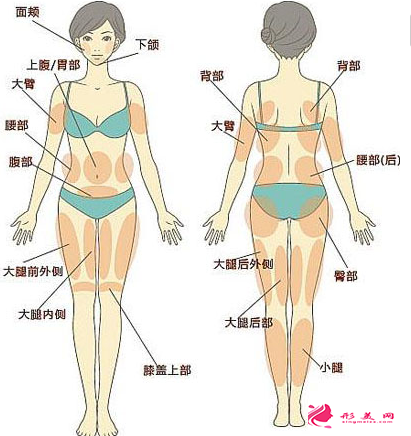 抽脂減肥后需要吃消炎藥嗎