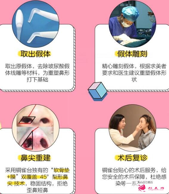 隆鼻失敗怎么辦？鼻修復(fù)手術(shù)過程