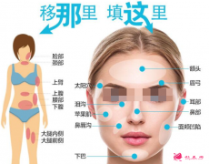 自體脂肪填充的恢復(fù)期是多久？