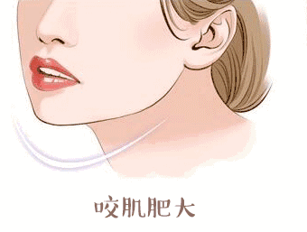 打瘦臉針后紅腫正常嗎