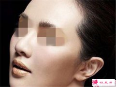 縮小鼻翼術(shù)中的內(nèi)切和外切式有哪些不同點？