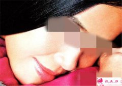唇部整形手術(shù)失敗過后如何做