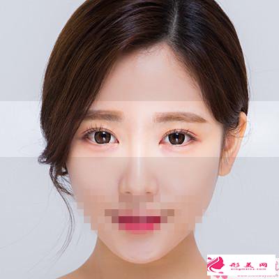 雙眼皮修復(fù)方法