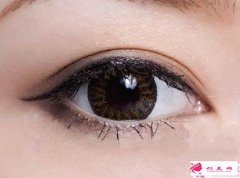 雙眼皮修復(fù)方法