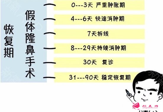 鼻子矯正術(shù)恢復期長嗎