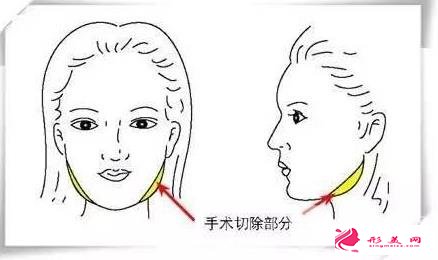 自身?xiàng)l件不同
