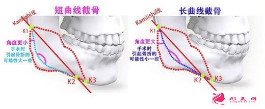 選取醫(yī)院不同