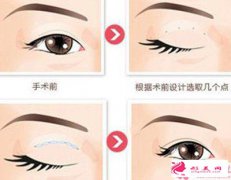 鼻整形手術(shù)價格多少錢？