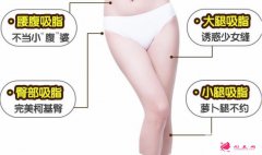 吸脂瘦大腿腫脹期是多久？教你如何護理