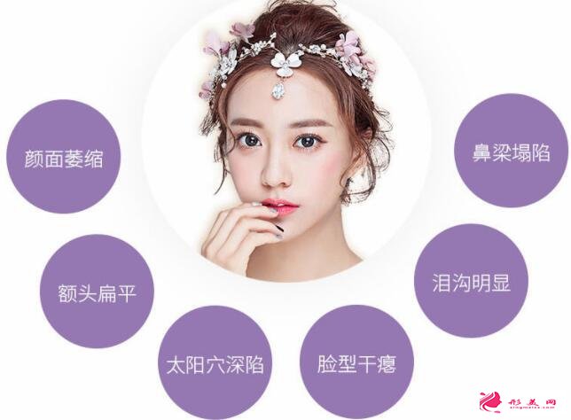 全面部自體脂肪填充效果:美圖放送~