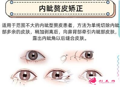 做開眼角手術多少錢?貧民窟女孩也能HOLD住
