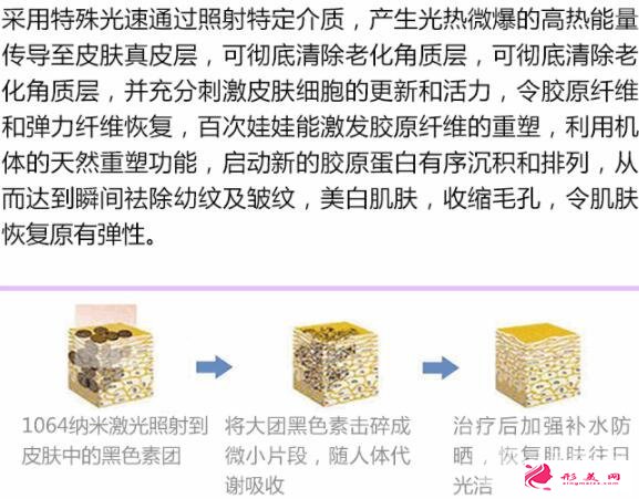 醫(yī)美小課堂:白瓷娃娃激光功效及效果圖
