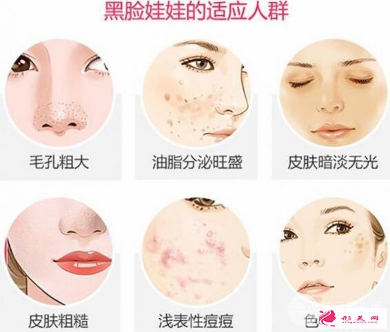 [美膚攻略]黑臉娃娃費用和效果