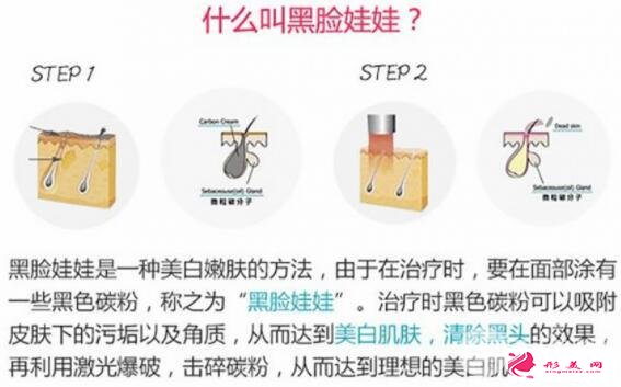 [美膚攻略]黑臉娃娃費用和效果