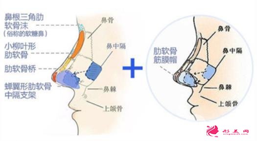 鼻子整形手術(shù)后的注意事項(xiàng)