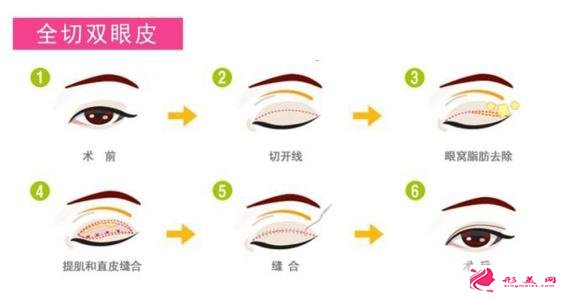 割雙眼皮對(duì)比圖，光看這些圖片就能感受到手術(shù)的優(yōu)勢(shì)